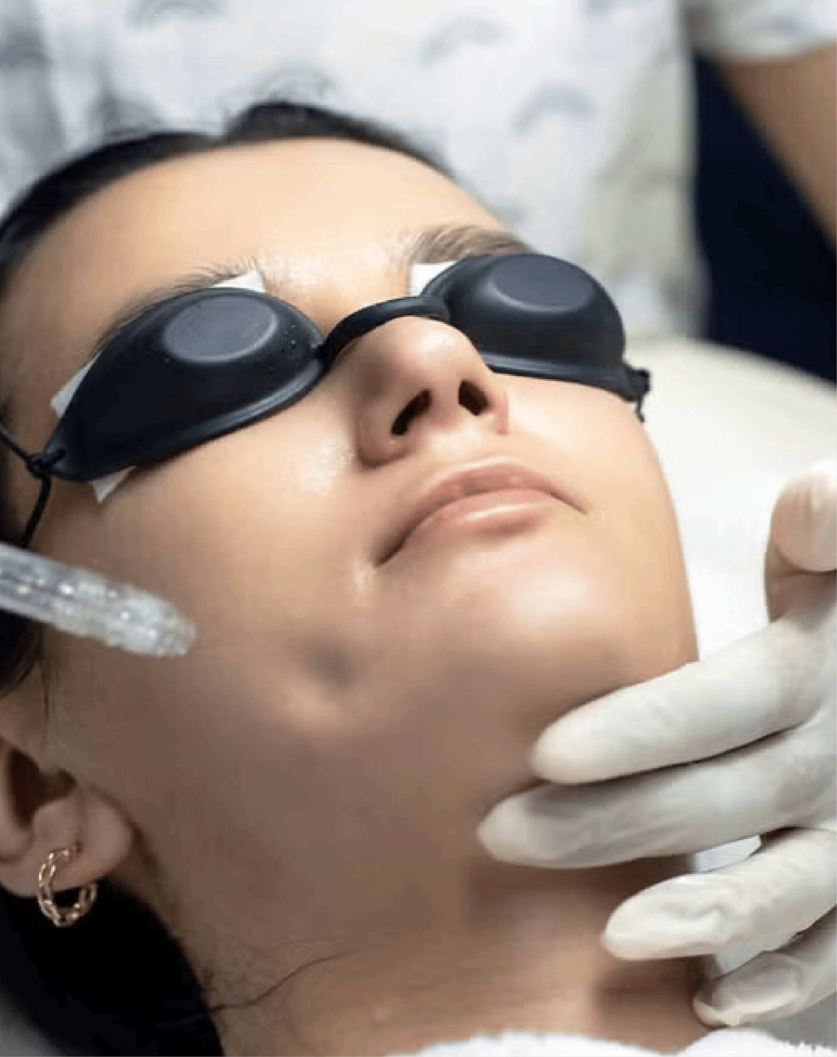 What to expect from JetPeel™ Infusion Facial by Xcite Tech treatment at Toronto medical spa - treatment journey